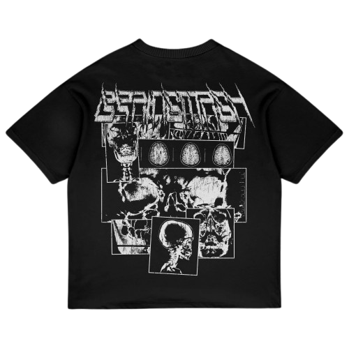 X-RAY TEE